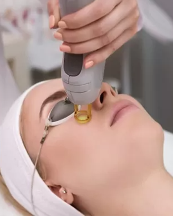 face laser treatment cosmo secrets