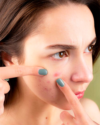 A women dealing with face scars. Face scar Treatment