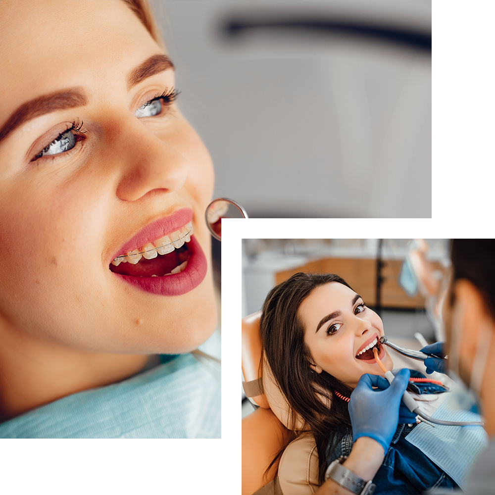 Dental Treatments, Dentals that will make your smile beautiful. Cosmo Secrets