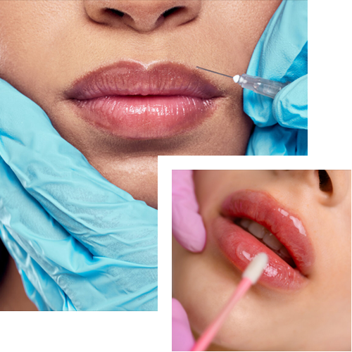 lip filler, cosmo secrets