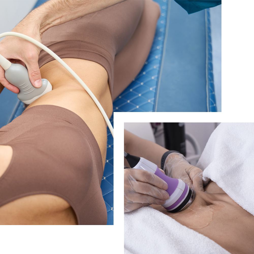 Body slimming treatment at Cosmo Secrets Medical Centre, featuring a patient undergoing a non-invasive procedure to reduce body fat and enhance body contours.