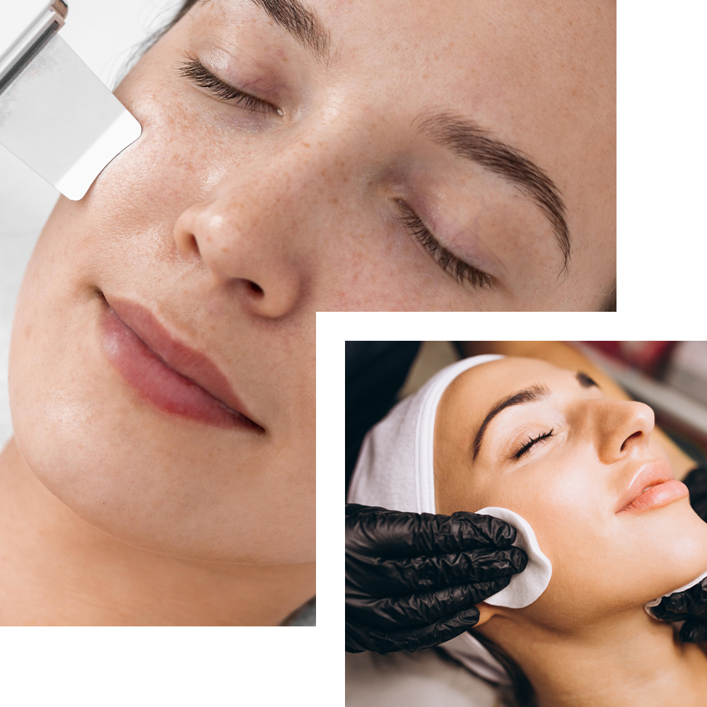 Microdermabrasion treatment at Cosmo Secrets Medical Centre, featuring a skincare professional using a handheld device to exfoliate the patient's skin, promoting a smoother and more radiant complexion."