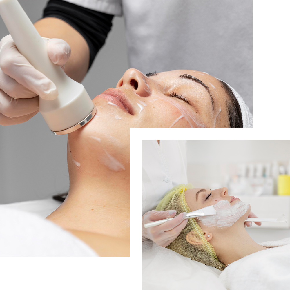 Chemical peeling treatment at Cosmo Secrets Medical Centre, exfoliating the skin to improve texture, tone, and reduce the appearance of fine lines.